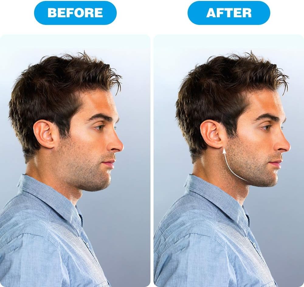 E-COSMOS Pack Of 2 Jawline Exerciser Double Chin Reducer